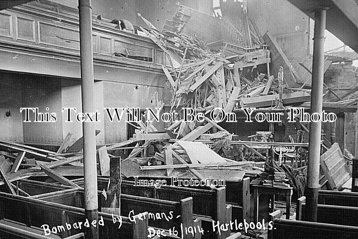 DU 2917 - German Bombardment Of Hartlepool, County Durham 1914