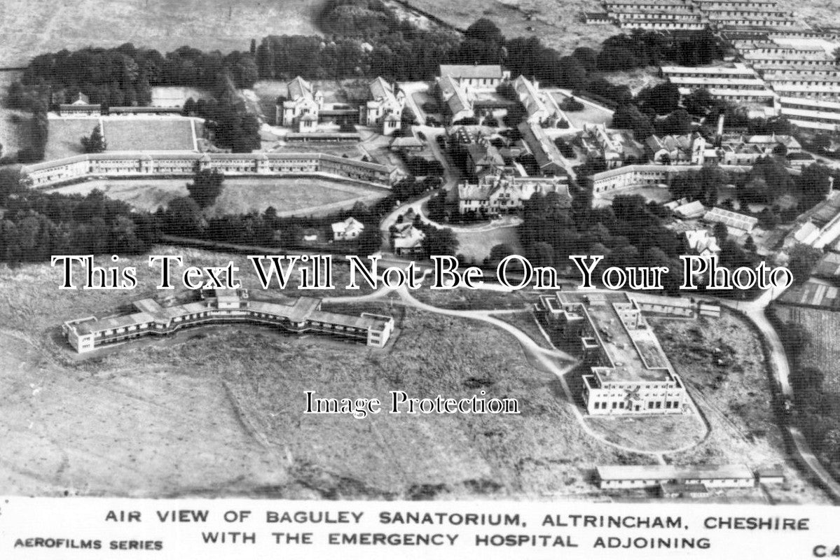 CH 1631 - Baguley Sanatorium & Hospital, Altrincham, Cheshire