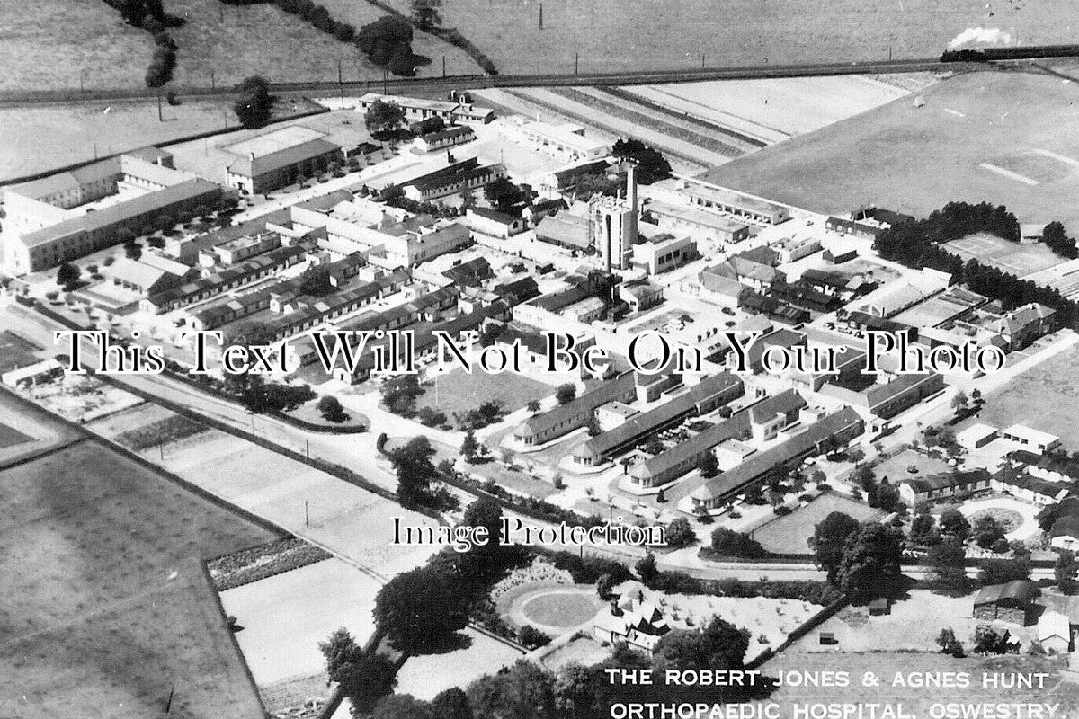 SH 986 - The Robert Jones & Agnes Hunt Hospital, Oswestry c1960