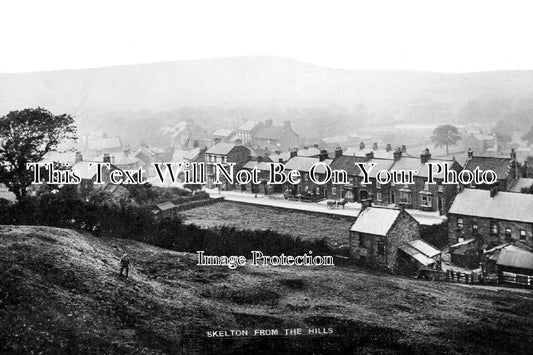 YO 6153 - Skelton From The Hills, Yorkshire