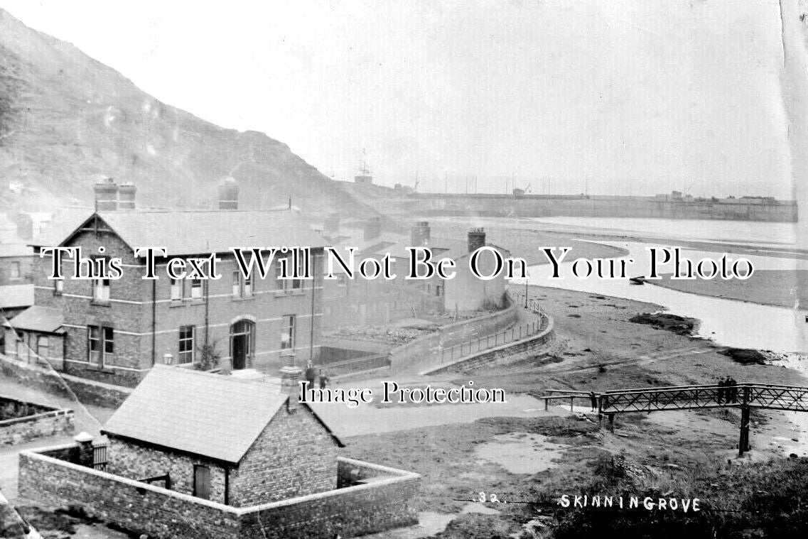 YO 7363 - Skinningrove Hospital, Yorkshire